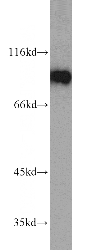 HepG2 cells were subjected to SDS PAGE followed by western blot with Catalog No:109821(DDX21 antibody) at dilution of 1:2000