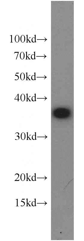 HEK-293 cells were subjected to SDS PAGE followed by western blot with Catalog No:110197(EIF3I antibody) at dilution of 1:1000