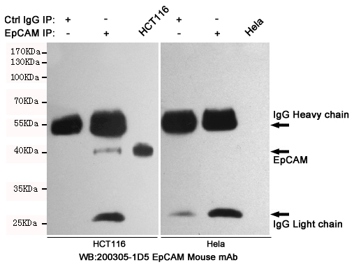 Immunoprecipitation analysis of HCT116 and Hela cell lysates using EpCAM.