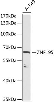Western blot - ZNF195 Polyclonal Antibody 