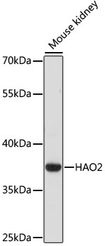 Western blot - HAO2 Polyclonal Antibody 