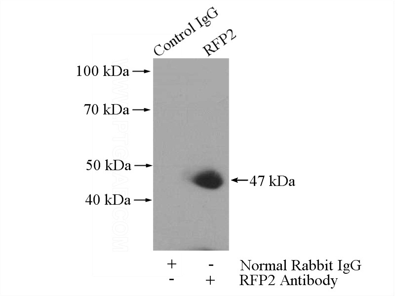 IP Result of anti-TRIM13 (IP:Catalog No:114629, 4ug; Detection:Catalog No:114629 1:1000) with Jurkat cells lysate 3200ug.