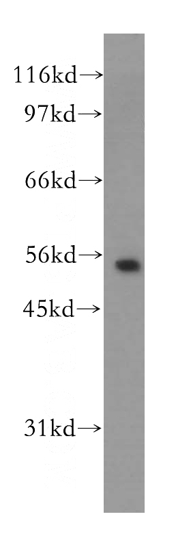 human brain tissue were subjected to SDS PAGE followed by western blot with Catalog No:112065(KCNJ16 antibody) at dilution of 1:400
