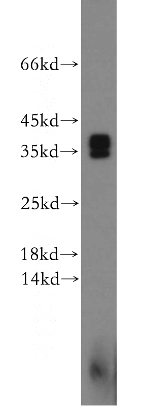 human brain tissue were subjected to SDS PAGE followed by western blot with Catalog No:115766(SYNGR4 antibody) at dilution of 1:300