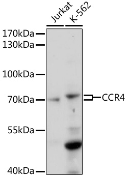 Western blot - CCR4 Polyclonal Antibody 