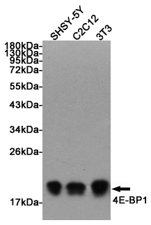 Western blot detection of 4E-BP1 in SHSY-5Y, C2C12 and 3T3 cell lysates using 4E-BP1 Rabbit pAb (1:1000 diluted). Predicted band size: 13KDa. Observed band size:15~20KDa.