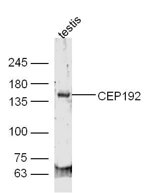 Fig3: Sample:; Testis (Mouse) Lysate at 40 ug; Primary: Anti-CEP192 at 1/300 dilution; Secondary: IRDye800CW Goat Anti-Rabbit IgG at 1/20000 dilution; Predicted band size: 213 kD; Observed band size: 150 kD