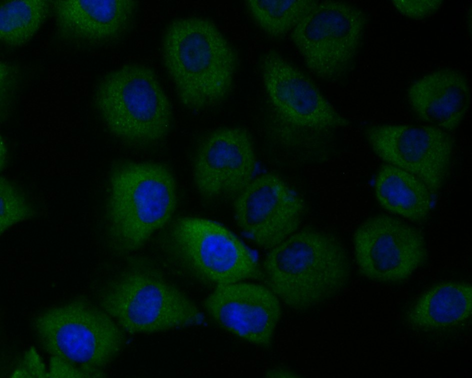 Fig2: ICC staining Tmem248 in HUVEC cells (green). The nuclear counter stain is DAPI (blue). Cells were fixed in paraformaldehyde, permeabilised with 0.25% Triton X100/PBS.