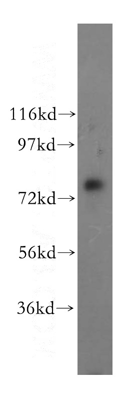 HepG2 cells were subjected to SDS PAGE followed by western blot with Catalog No:115866(TBC1D23 antibody) at dilution of 1:500