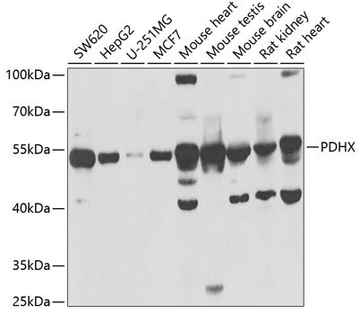 Western blot - PDHX Polyclonal Antibody 