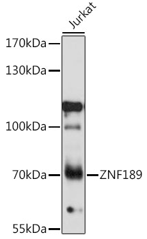 Western blot - ZNF189 Polyclonal Antibody 