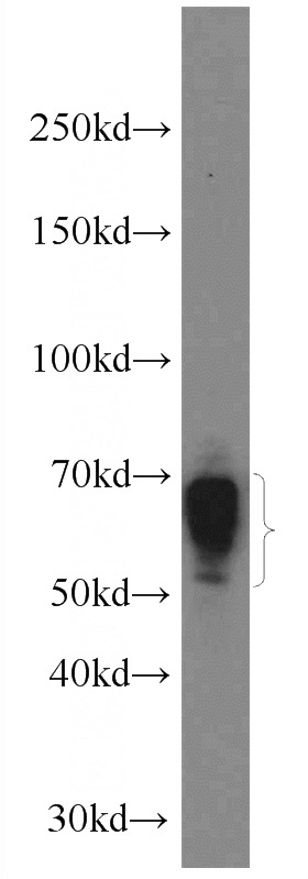 Raji cells were subjected to SDS PAGE followed by western blot with Catalog No:111695(IGHD antibody) at dilution of 1:600