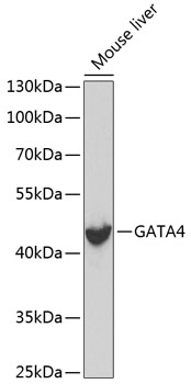 Western blot - GATA4 Monoclonal Antibody 