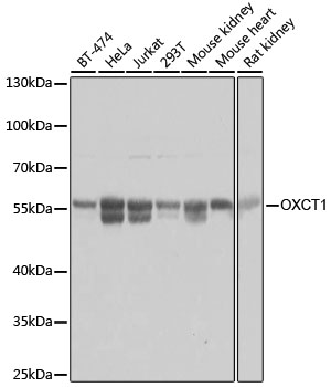 Western blot - OXCT1 Polyclonal Antibody 