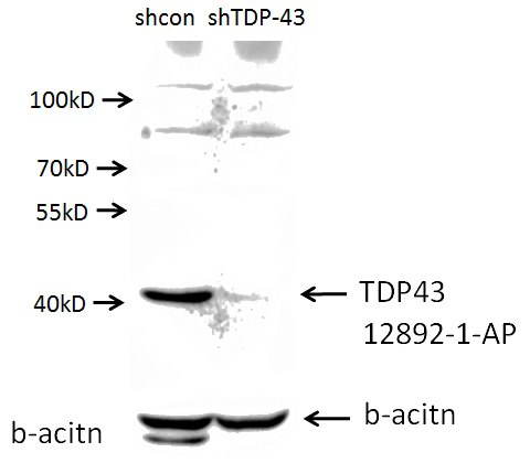 A549 cells (shcontrol and shRNA of TDP43) were subjected to SDS PAGE followed by western blot with Catalog No:115926 (TDP43 antibody) at dilution of 1:1000. (Data provided by Angran Biotech (www.miRNAlab.com)).