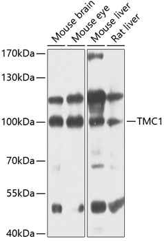 Western blot - TMC1 Polyclonal Antibody 