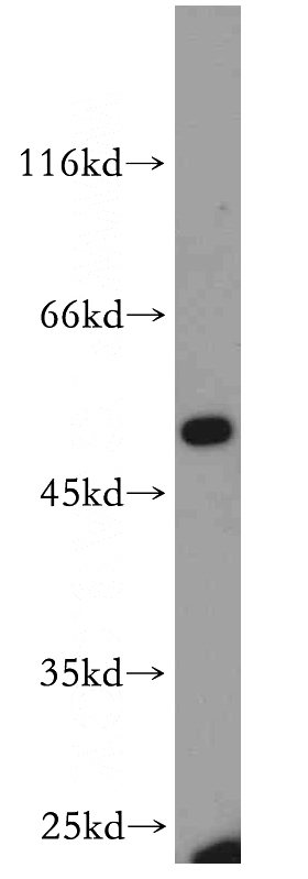A431 cells were subjected to SDS PAGE followed by western blot with Catalog No:110346(EPCAM antibody) at dilution of 1:200