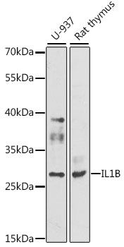 Western blot - IL1B Polyclonal Antibody. Western blot analysis of extracts of various cell lines, using IL1B antibody .Secondary antibody: HRP Goat Anti-Rabbit IgG at 1:10000 dilution.Lysates/proteins: 25ug per lane.Blocking buffer: 3% nonfat dry milk in TBST.