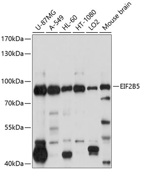 Western blot - EIF2B5 Polyclonal Antibody 