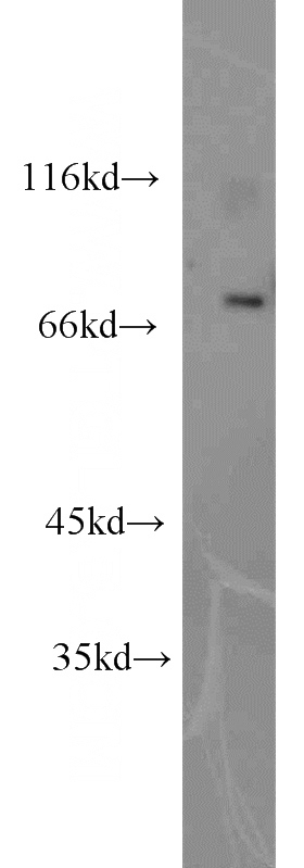 human heart tissue were subjected to SDS PAGE followed by western blot with Catalog No:109163(CDK5RAP1 antibody) at dilution of 1:2000