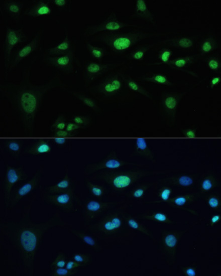 Immunofluorescence - MDC1 Polyclonal Antibody 