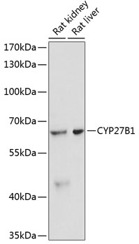 Western blot - CYP27B1 Polyclonal Antibody 