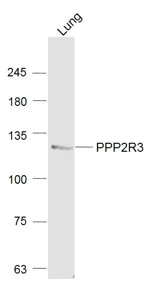 Fig1: Sample:; Lung (Mouse) Lysate at 40 ug; Primary: Anti- PPP2R3 at 1/1000 dilution; Secondary: IRDye800CW Goat Anti-Rabbit IgG at 1/20000 dilution; Predicted band size: 130 kD; Observed band size: 130 kD