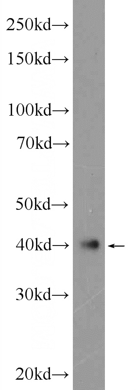 human testis tissue were subjected to SDS PAGE followed by western blot with Catalog No:117070(ATXN3L Antibody) at dilution of 1:600