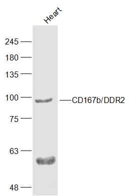 Fig1: Sample:; Heart(Mouse) Cell Lysate at 40 ug; Primary: Anti-CD167b/DDR2 at 1/300 dilution; Secondary: IRDye800CW Goat Anti-Rabbit IgG at 1/20000 dilution; Predicted band size: 92 kD; Observed band size: 92 kD