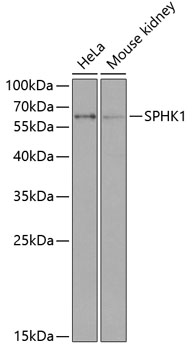 Western blot - SPHK1 Polyclonal Antibody 
