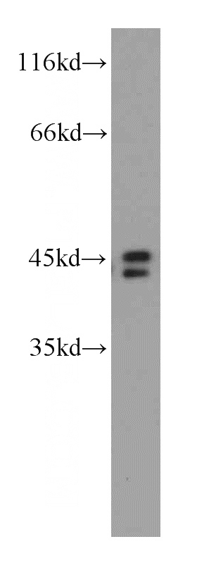 HeLa cells were subjected to SDS PAGE followed by western blot with Catalog No:116163(TOB1 antibody) at dilution of 1:1000