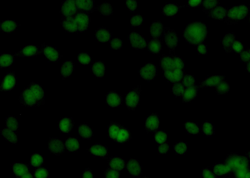 Immunofluorescent analysis of BxPC-3 cells using Catalog No:116336(TKT Antibody) at dilution of 1:25 and Alexa Fluor 488-congugated AffiniPure Goat Anti-Rabbit IgG(H+L)