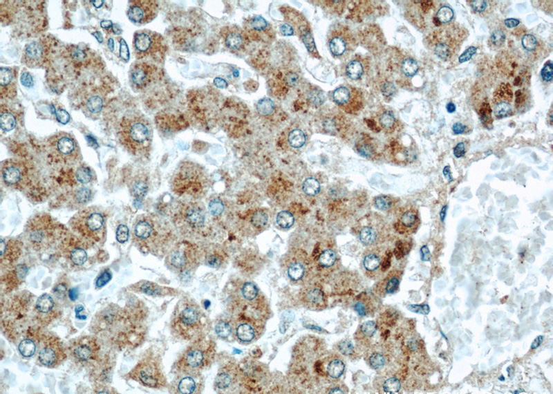 Immunohistochemical of paraffin-embedded human liver using Catalog No:109416(CMTM8 antibody) at dilution of 1:50 (under 40x lens)