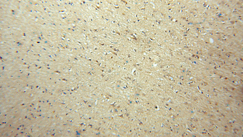 Immunohistochemical of paraffin-embedded human brain using Catalog No:107797(ADO antibody) at dilution of 1:50 (under 10x lens)