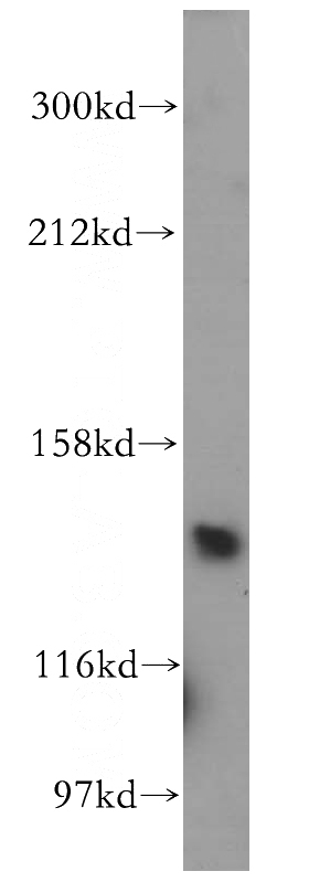 Y79 cells were subjected to SDS PAGE followed by western blot with Catalog No:111106(GPR116 antibody) at dilution of 1:300