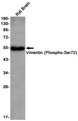 Western blot detection of Vimentin (Phospho-Ser72) in Rat Brain lysates using Vimentin (Phospho-Ser72) Rabbit pAb(1:1000 diluted).Predicted band size:54kDa.Observed band size:54kDa.
