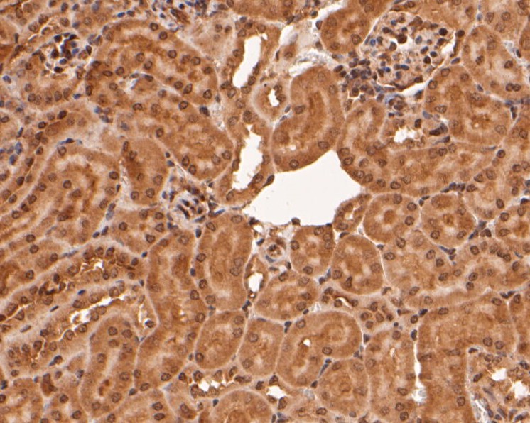 Fig8: Immunohistochemical analysis of paraffin-embedded mouse kidney tissue using anti-RBPMS antibody. The section was pre-treated using heat mediated antigen retrieval with sodium citrate buffer (pH 6.0) for 20 minutes. The tissues were blocked in 5% BSA