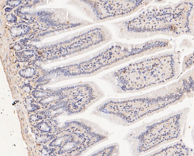 Fig6:; Immunohistochemical analysis of paraffin-embedded mouse colon tissue using anti-FYCO1 antibody. The section was pre-treated using heat mediated antigen retrieval with Tris-EDTA buffer (pH 8.0-8.4) for 20 minutes.The tissues were blocked in 5% BSA for 30 minutes at room temperature, washed with ddH; 2; O and PBS, and then probed with the primary antibody ( 1/500) for 30 minutes at room temperature. The detection was performed using an HRP conjugated compact polymer system. DAB was used as the chromogen. Tissues were counterstained with hematoxylin and mounted with DPX.