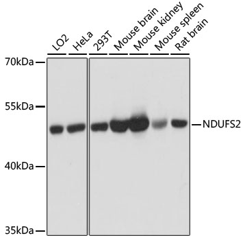 Western blot - NDUFS2 Polyclonal Antibody 