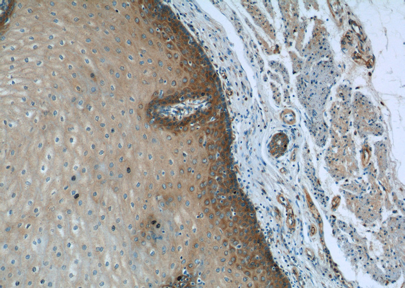 Immunohistochemistry of paraffin-embedded human oesophagus tissue slide using Catalog No:113788(PGLYRP4 Antibody) at dilution of 1:50 (under 10x lens)