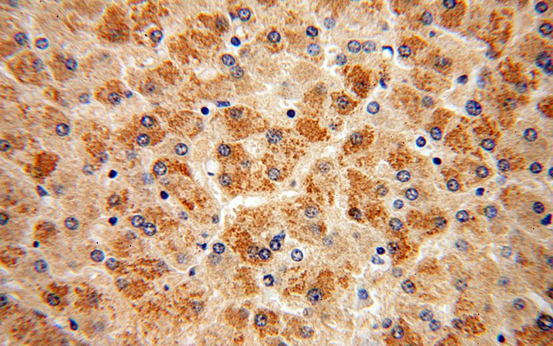 Immunohistochemical of paraffin-embedded human liver using Catalog No:109468(COQ10A antibody) at dilution of 1:100 (under 40x lens)