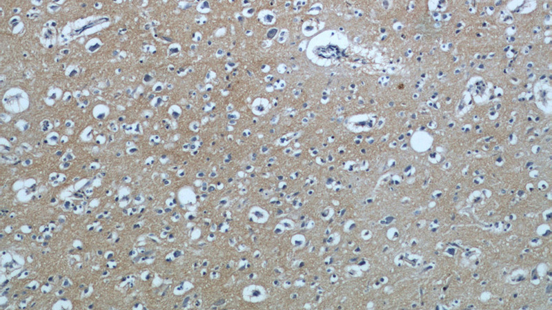 Immunohistochemical of paraffin-embedded human brain using Catalog No:110159(SLC1A1 antibody) at dilution of 1:50 (under 10x lens)