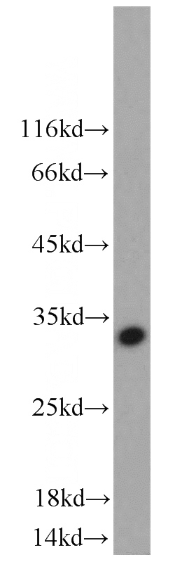 Jurkat cells were subjected to SDS PAGE followed by western blot with Catalog No:113197(KLRC1 antibody) at dilution of 1:800