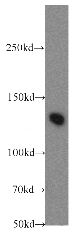 mouse brain tissue were subjected to SDS PAGE followed by western blot with Catalog No:116414(TRPS1 antibody) at dilution of 1:100