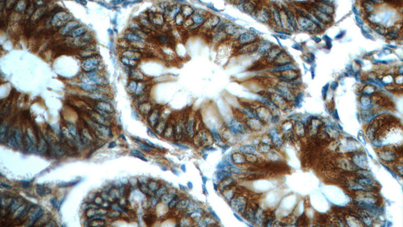 Immunohistochemistry of paraffin-embedded human colon tissue slide using Catalog No:110718(FPGT Antibody) at dilution of 1:50 (under 40x lens)