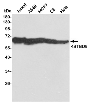 Western blot detection of KBTBD8 in Jurkat,A549,MCF7,C6 and Hela cell lysates using KBTBD8 mouse mAb (1:1000 diluted).Predicted band size:69KDa.Observed band size:69KDa.