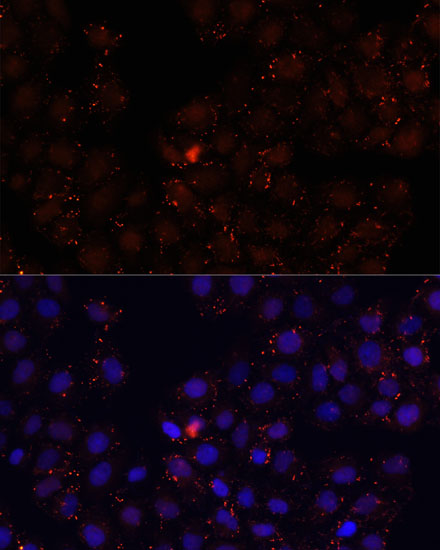 Immunofluorescence - WDR81 Polyclonal Antibody 