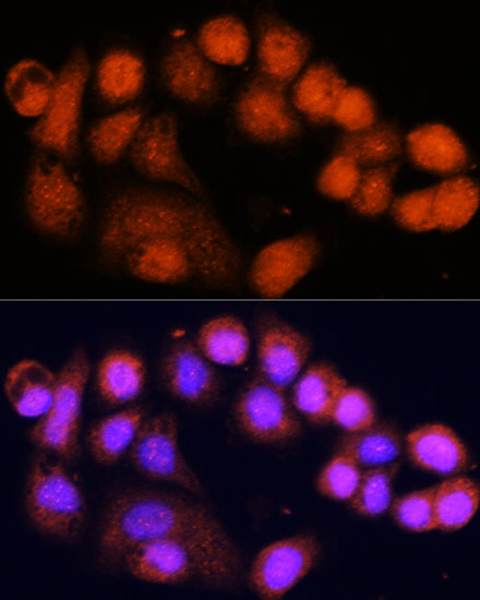Immunofluorescence - MSH4 Polyclonal Antibody 