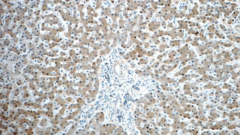 Immunohistochemistry of paraffin-embedded human liver slide using Catalog No:107406(ARG1 Antibody) at dilution of 1:50