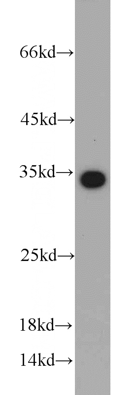 PC-3 cells were subjected to SDS PAGE followed by western blot with Catalog No:110312(EEF1B2 antibody) at dilution of 1:1000